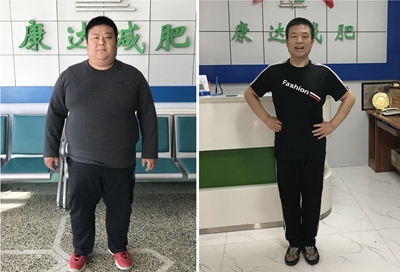 刘小冬在长春康达减肥医院瘦179斤1