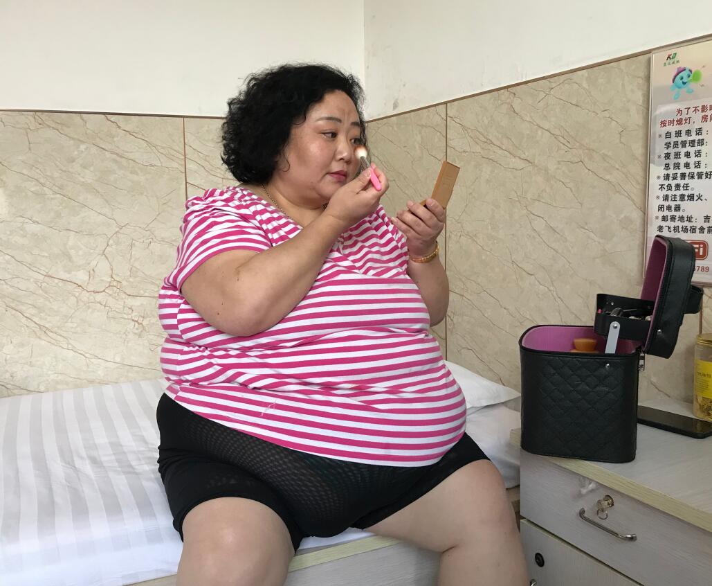 刘艳艳在长春康达医院四个月瘦72斤5