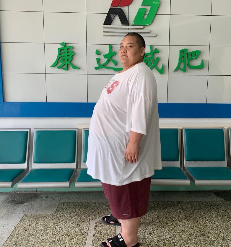 在长春康达医院减肥两个月，甘肃胖小伙铲肉74斤5