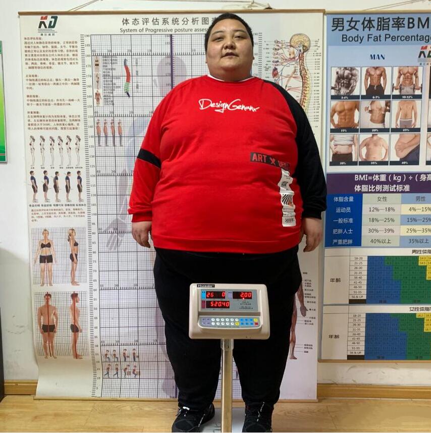 在长春康达医院减肥两个月，甘肃胖小伙铲肉74斤2
