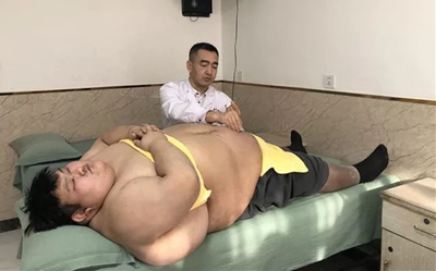 湖南胖小伙在长春康达医院10天减30斤2