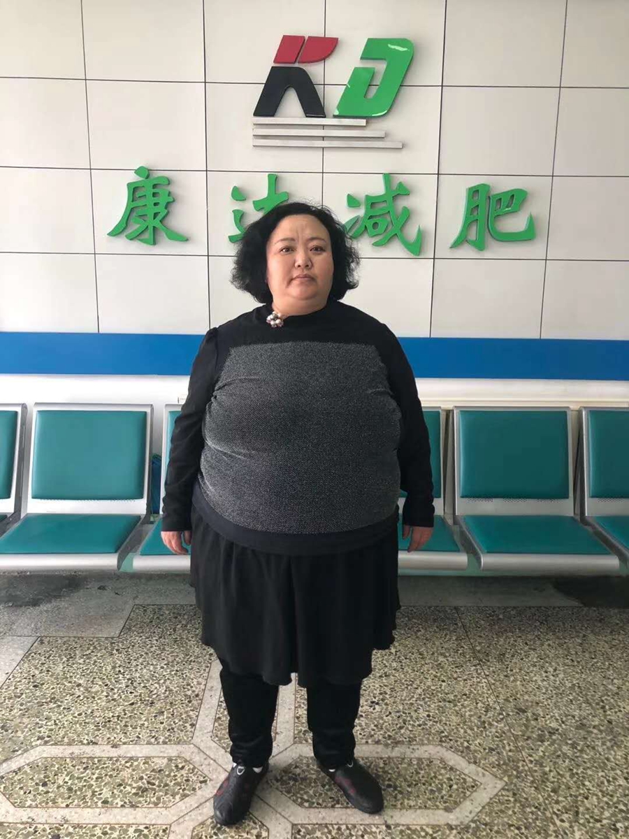 刘艳艳长春康达减肥七个月瘦百余斤2