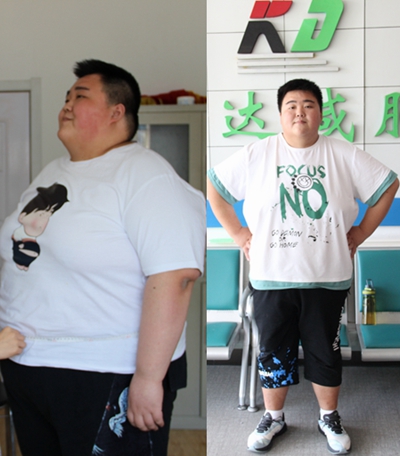 胖小伙在长春康达减肥仨月瘦95斤1