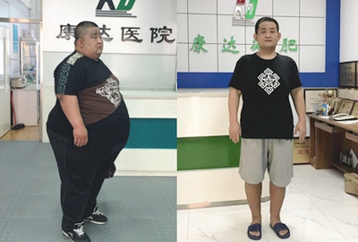 500斤河北衡水男子刘尚涛在长春减肥15个月暴瘦314斤4