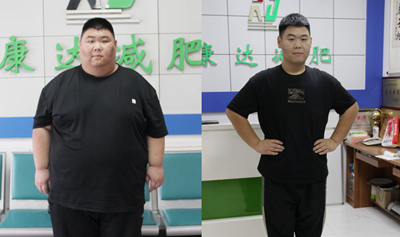 近700斤兄妹到长春康达减肥，哥哥七个月减下190斤1